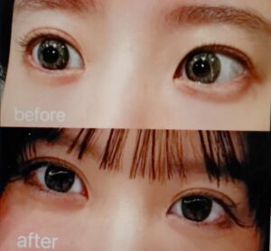 藤川らるむ2024年二重整形
