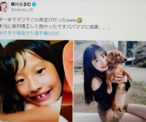 歯科矯正前の藤川らるむ